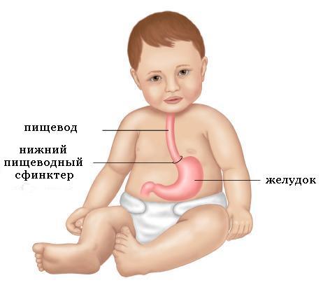 Гастроэзофагеальный рефлюкс, пищевод, желудок, кардия