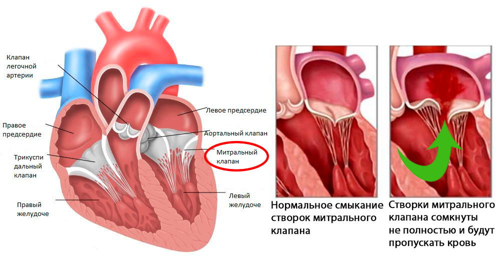 Левый клапан. Анатомия митрального клапана сердца. Митральный клапан это клапан. Анатомия клапана легочной артерии. Недостаточность клапана регургитация.