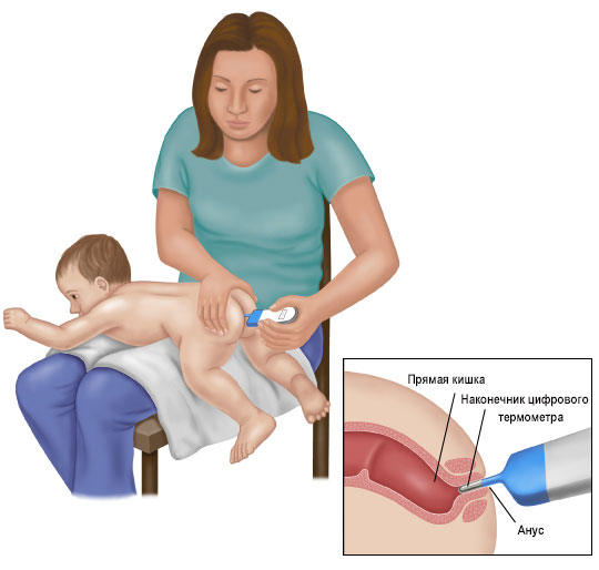 Лихорадка у ребенка: как сбивать температуру