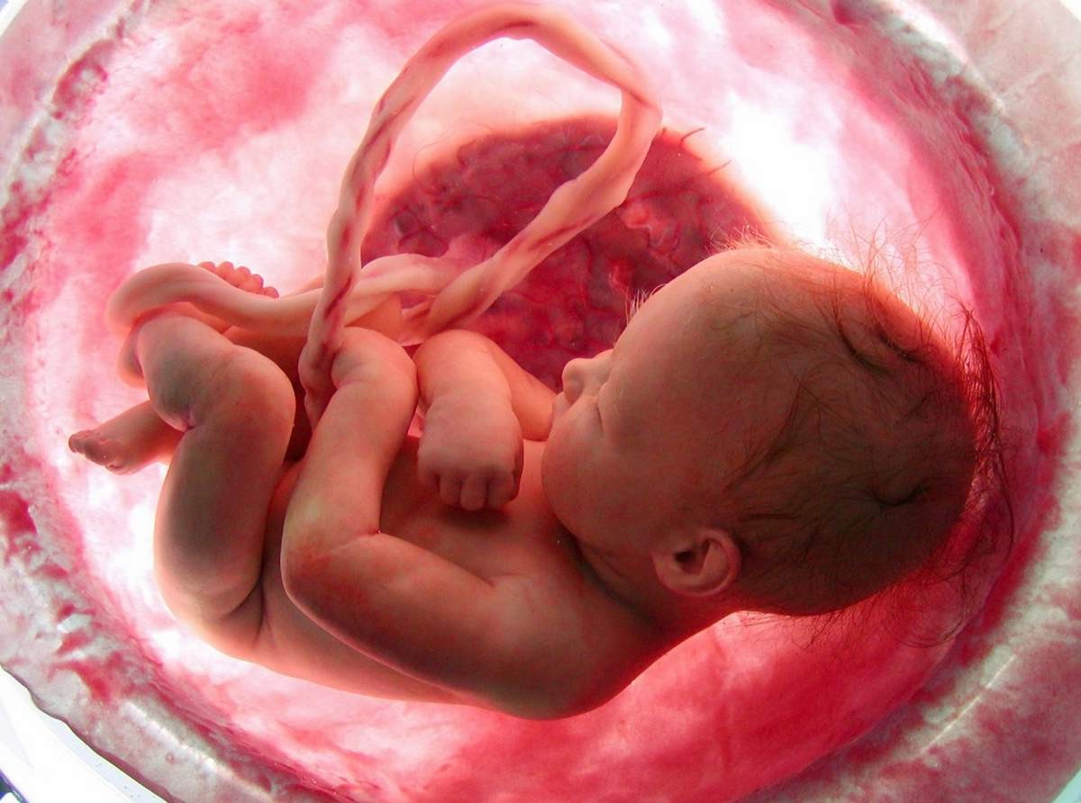Пупок новорождённого – общий вид, уход и отпадание