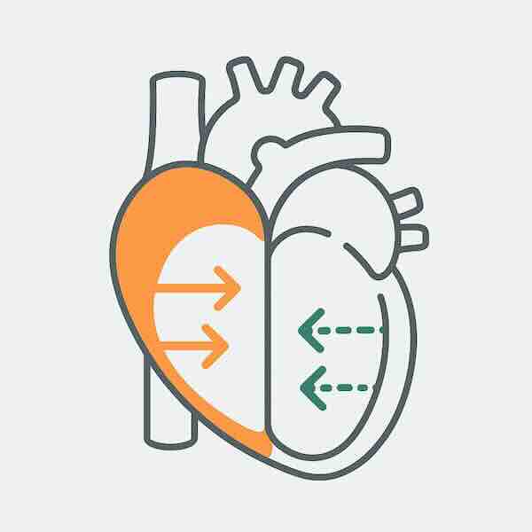 Минималистичная схема: сердце по центру; слева стрелки наружу — систола (выталкивание), справа пунктирные стрелки внутрь — диастола (наполнение). Flat-style, без текста. Минималистичная схема: сердце по центру; слева стрелки наружу — систола (выталкивание), справа пунктирные стрелки внутрь — диастола (наполнение). Flat-style, без текста.