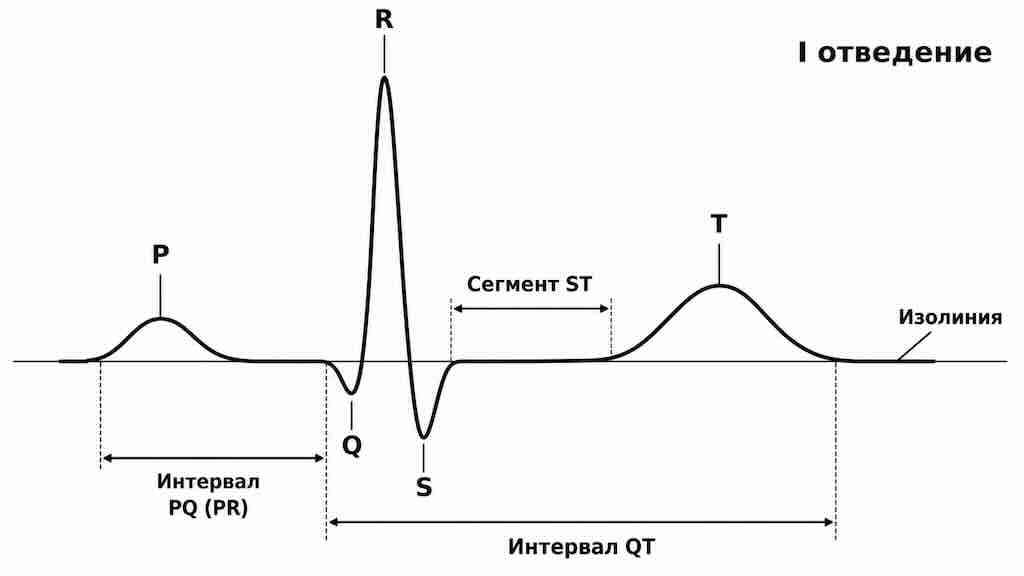 Зубцы и интервалы ЭКГ в одном сердечном цикле: P, PQ (PR), QRS, ST, T и QT