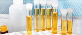 Бессимптомная бактериурия. Об избыточном назначении антибиотиков