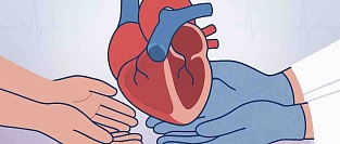  Врожденные пороки сердца у детей: что это значит и чего ждать