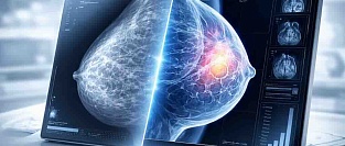 МРТ как дополнение к маммографии. Модель и ее результаты