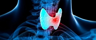 Рак щитовидной железы. Позиция USPSTF по скринингу 2017