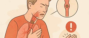 Инородное тело в дыхательных путях: признаки, первая помощь, что делать