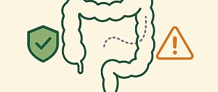 Риски колоноскопии: осложнения, частота и контекст безопасности