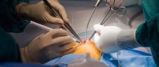 Длительность хирургической операции и риск тромбообразования