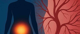 Вагинальные эстрогены после инсульта: новое исследование не подтвердило опасения