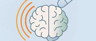 Открытое («честное») плацебо в лечении мигрени