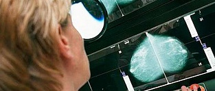 Ранние симптомы рака. Как на них реагируют пациенты?