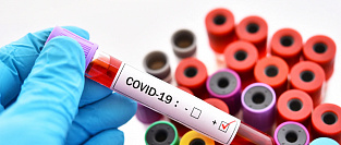 COVID-19. Нужна ли вакцинация после перенесенного заболевания?