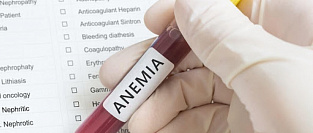 Железодефицитная анемия (ЖДА). Симптомы, лечение, профилактика