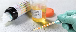 Микроальбуминурия. Простой прогностический тест