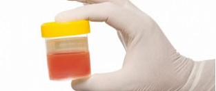 Рекомендации ACP по ведению пациентов с гематурией 2016